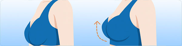 Breast Sculpting Preview