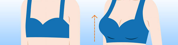 Breast Augmentation Preview