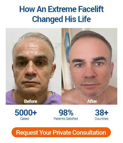 Đăng ký ngay