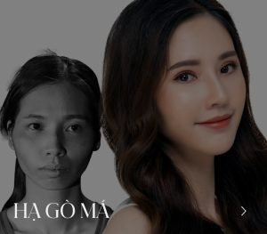 Maxillofacial  Surgery
