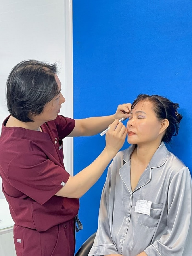 Mark, sketch, measure the new eyelid fold 