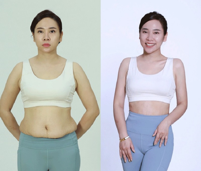 Eliminate belly fat to create a firm, slim abdomen 