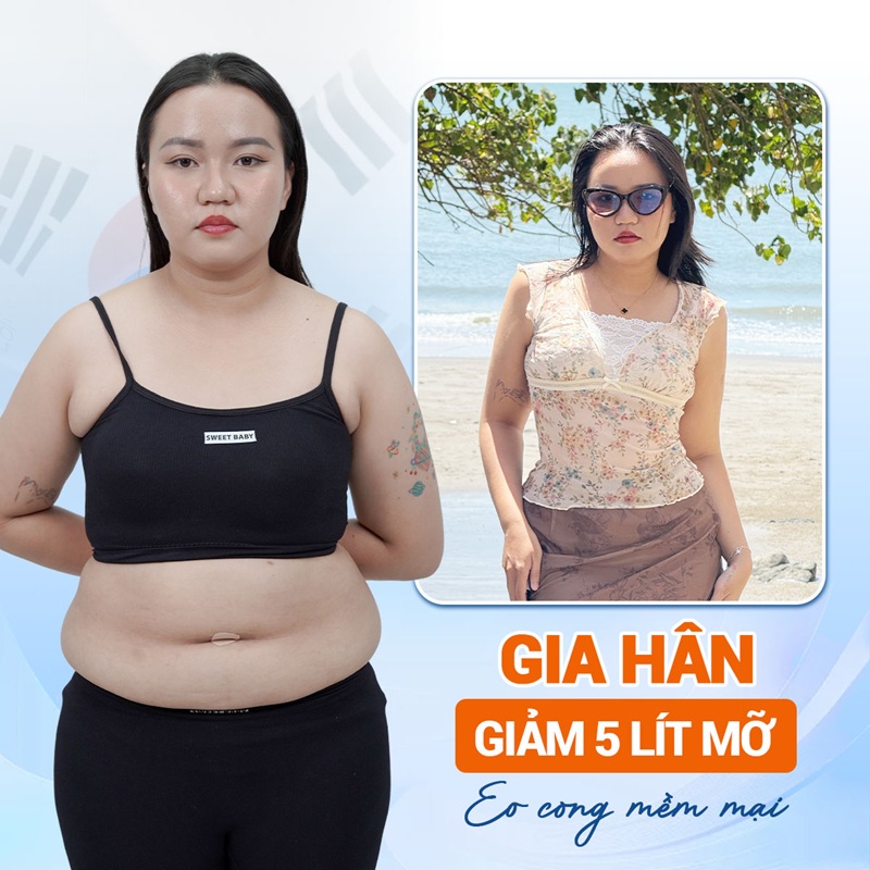 Liposuction is suitable for people with localized fat in the abdominal area.