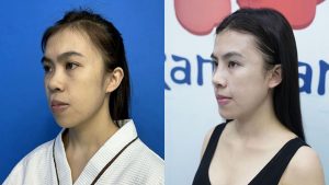 The Journey Finding the ‘Dream Nose’ of Gen Z’s Thanh Tam