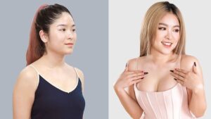 Plastic Surgery: A Comprehensive Overview for International Patients