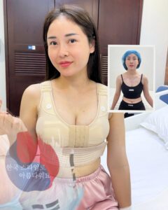 Breast Augmentation in Vietnam Price: Reference Cost Guide and Key Factors That Affect the Final Fee