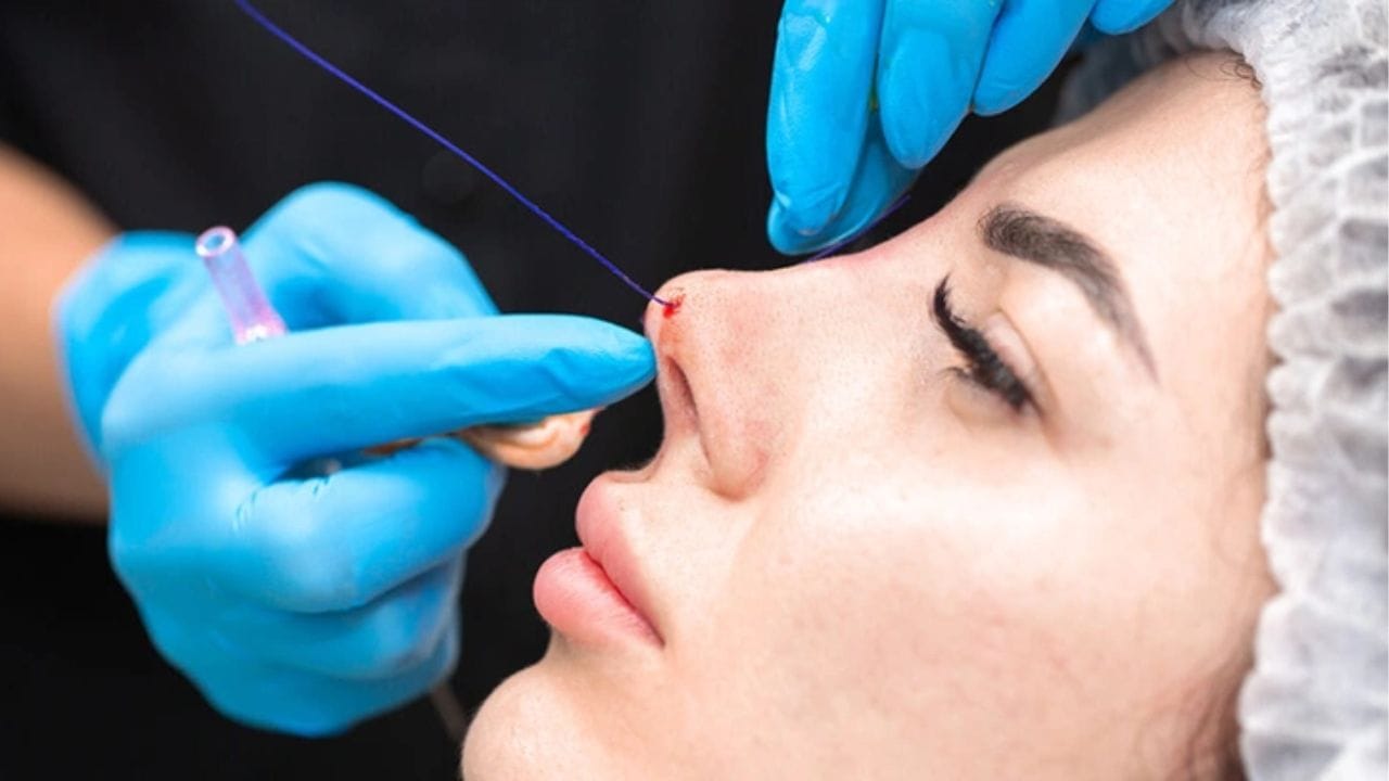 The nose needs time to fully heal and settle into its final shape.