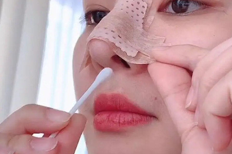 Keep the nose area clean and avoid touching or pressing it.