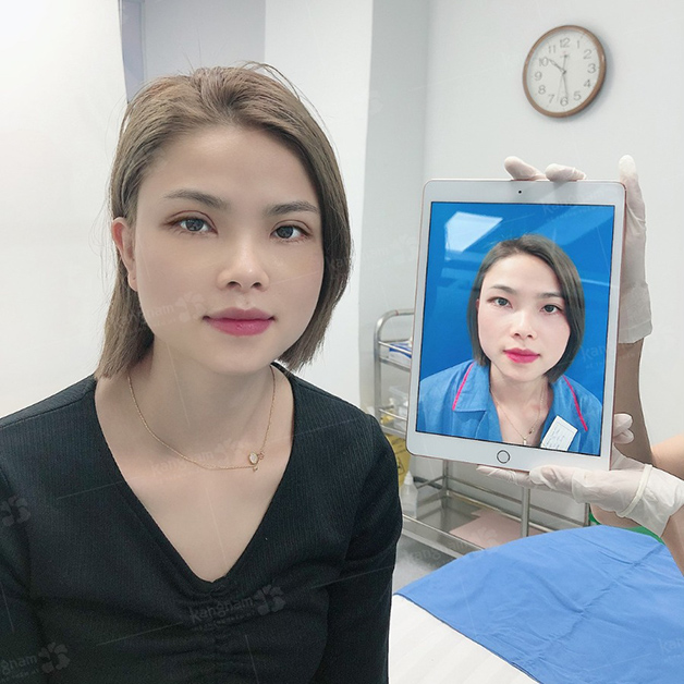 Kangnam is a preferred destination for eyelid surgery among international clients.