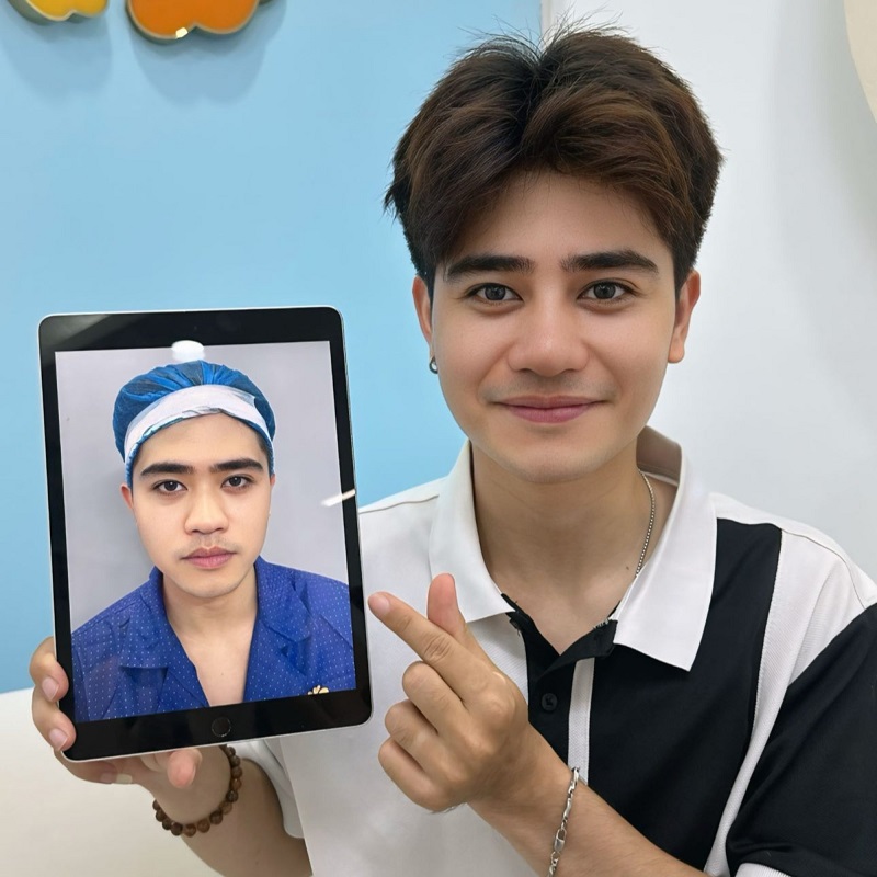 The client's eyelids recovered after a few days.