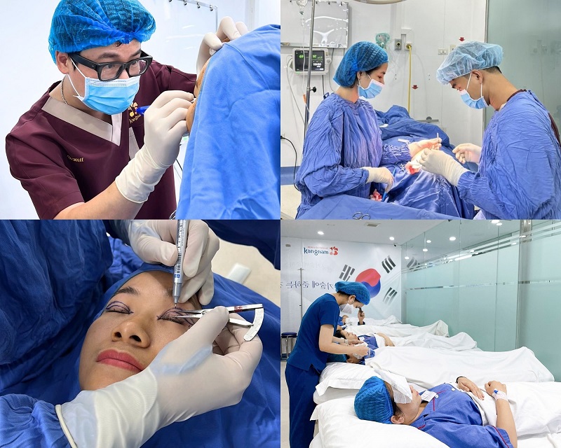 Kangnam is a leading and reputable clinic for eyelid surgery.