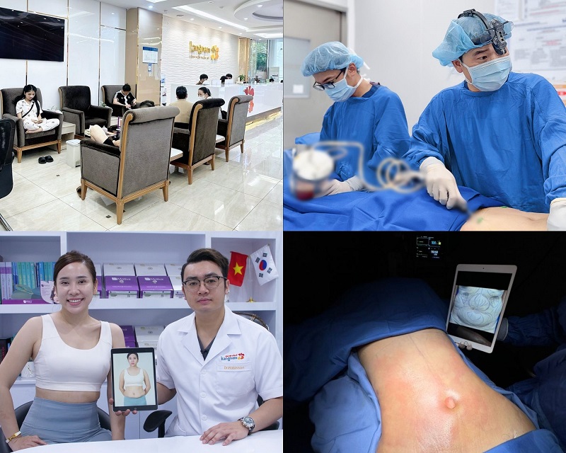 Kangnam Aesthetic Hospital is a leading liposuction clinic in Vietnam.