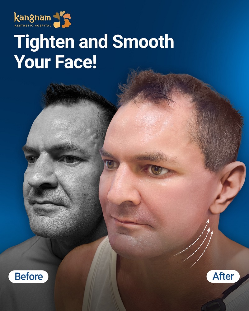 Natural and safe aesthetic results