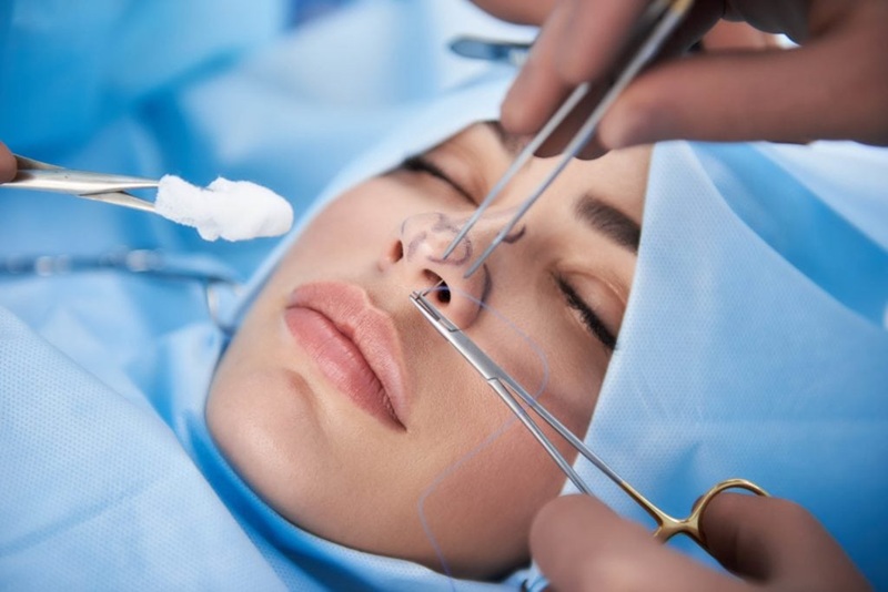 A safe rhinoplasty procedure, performed by a specialist doctor.