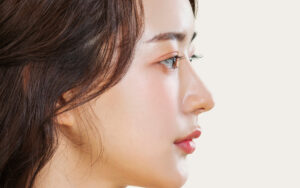 Is Rhinoplasty Considered Major Surgery? Procedure & Recovery