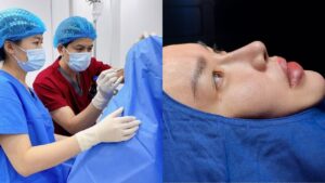 How to choose a rhinoplasty surgeon. Top 4 reputable rhinoplasty surgeons.