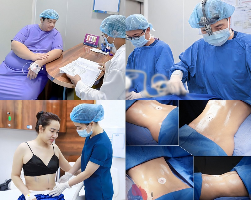 Overview of Kangnam Saigon Aesthetic Hospital, a reputable liposuction destination for international clients.
