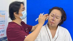 Facelift in Ho Chi Minh City: Costs, Reputable Surgeons, Travel Plans for Out-of-Town Clients, and What You Need to Know