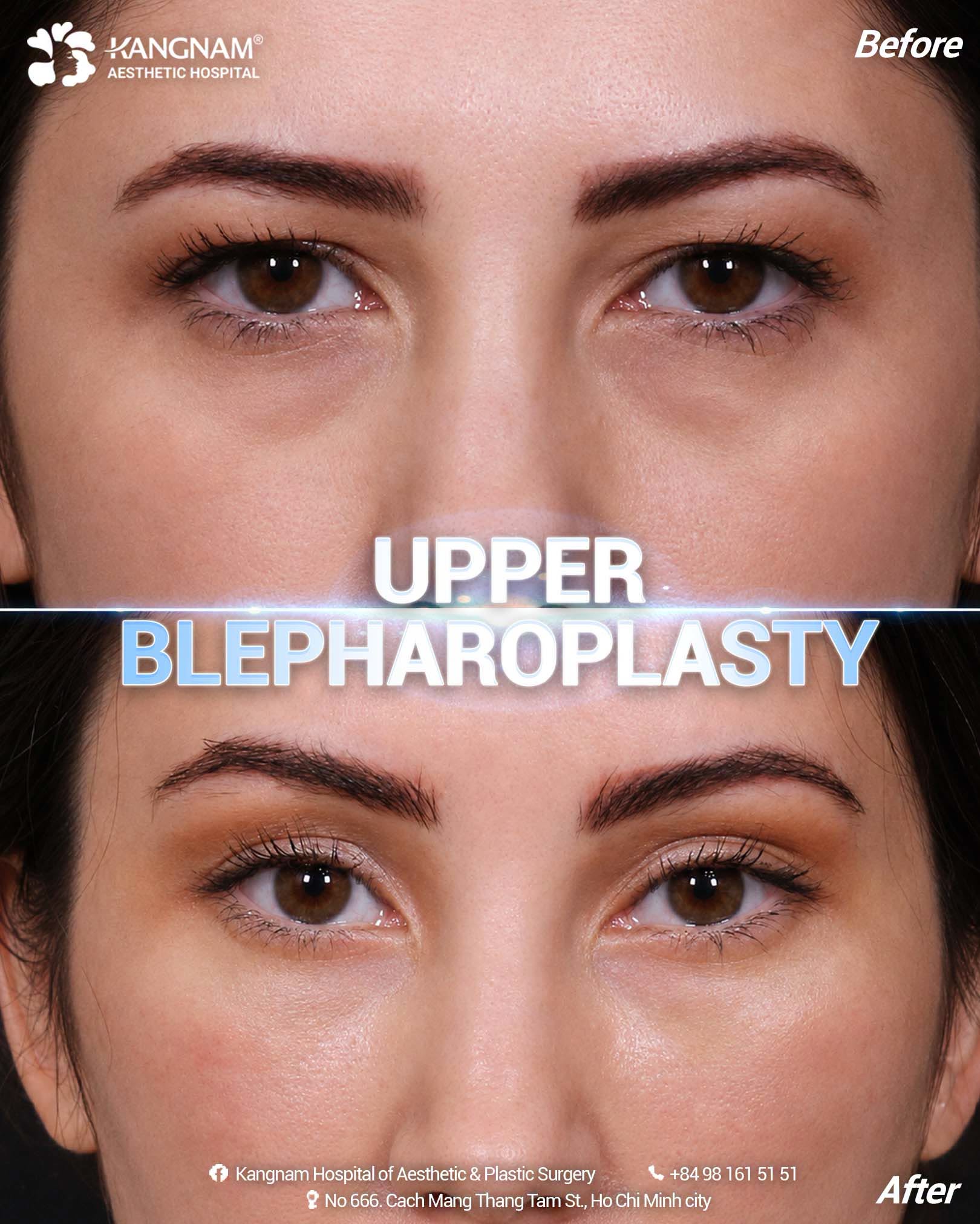 The eyelid wound is dry and no longer oozing fluid. 