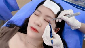 Forgotten Sutures After Eyelid Surgery: Is It Dangerous & How to Handle It?