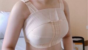 How long should a compression garment be worn after a breast lift? Guide to wearing the garment correctly.