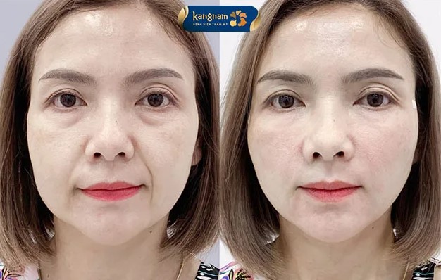 Proper care helps the skin recover quickly. 