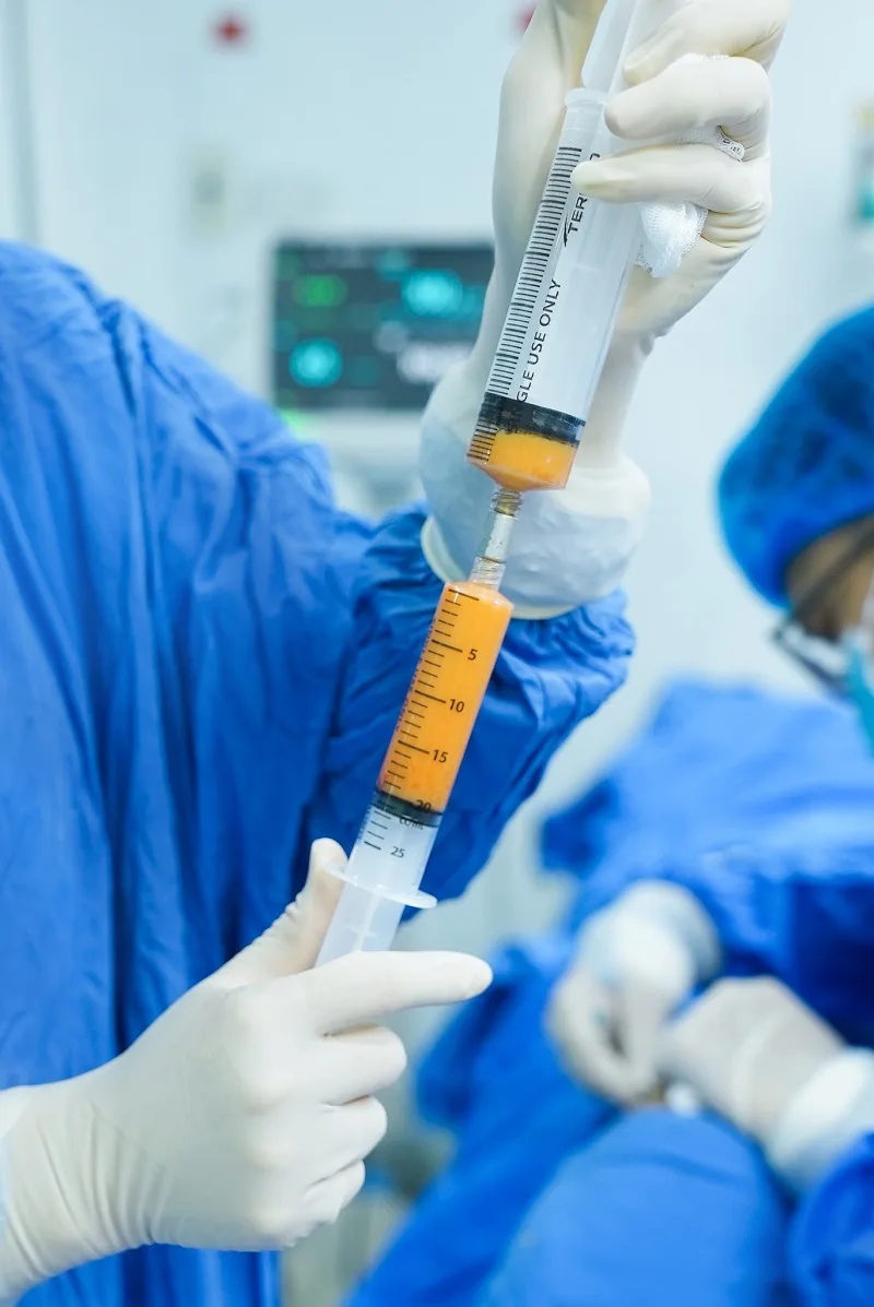 Kangnam Aesthetic Hospital employs BioFat regenerative fat grafting. 