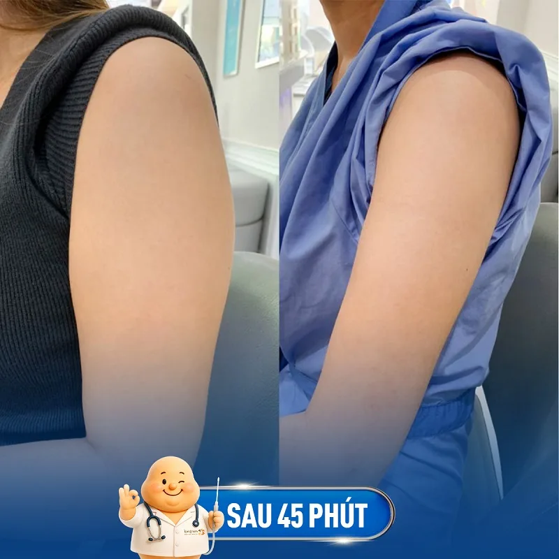 The upper arm area will heal after a few weeks