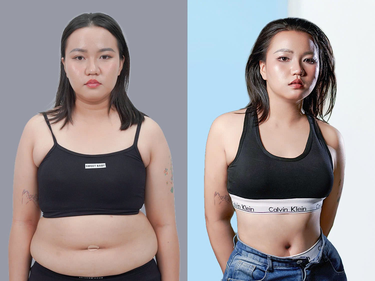 Customers should choose an aesthetic facility that utilizes modern liposuction technology. 