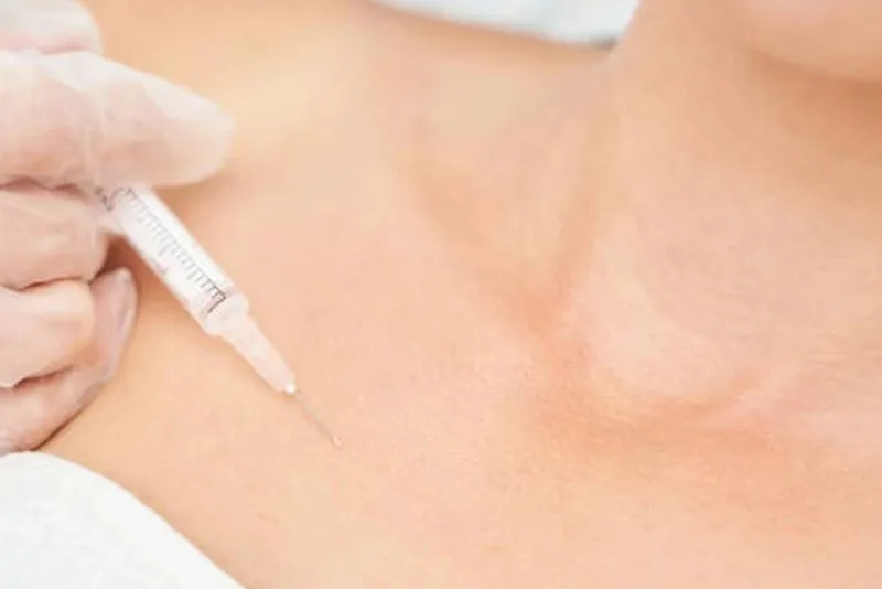Breast filler injections increase breast volume quickly