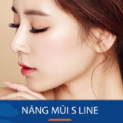 Nữ Việt Kiều Nâng mũi S Line – Công nghệ nâng mũi tự nhiên