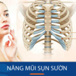 Nâng mũi sụn sườn cho KH việt kiều: Địa chỉ nâng mũi uy tín