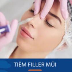 Tiêm filler mũi cho KH việt kiều – Thay đổi diện mạo tự nhiên