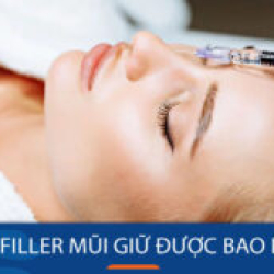 Tiêm filler mũi giữ được bao lâu? Bí quyết duy trì filler mũi