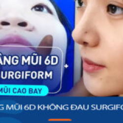 Nâng mũi 6D không đau Surgiform – Mũi đẹp toàn diện theo nét riêng