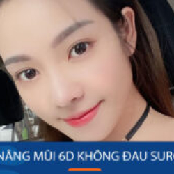 Chi phí nâng mũi 6D không đau Surgiform tại Kangnam? Bảng giá chi tiết