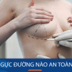 Phẫu thuật nâng ngực bằng đường nào an toàn: Không đau – Không sẹo – Hồi phục nhanh
