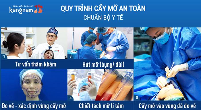 Quy trình cấy mỡ Nanofat