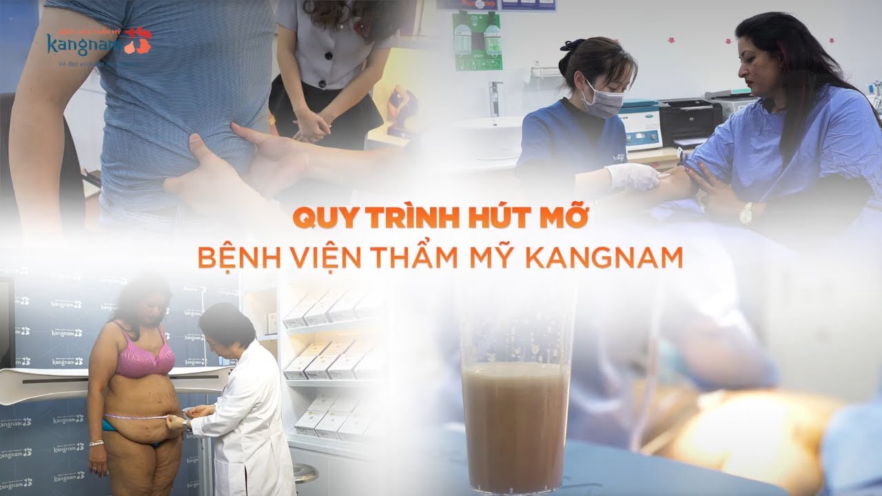 Quy trình hút mỡ Vaser 4D