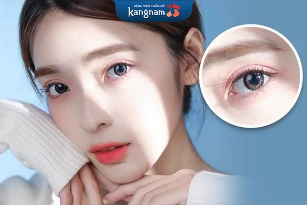 Mí mắt hồi phục cực nhanh sau cắt mí Perfect Eyes