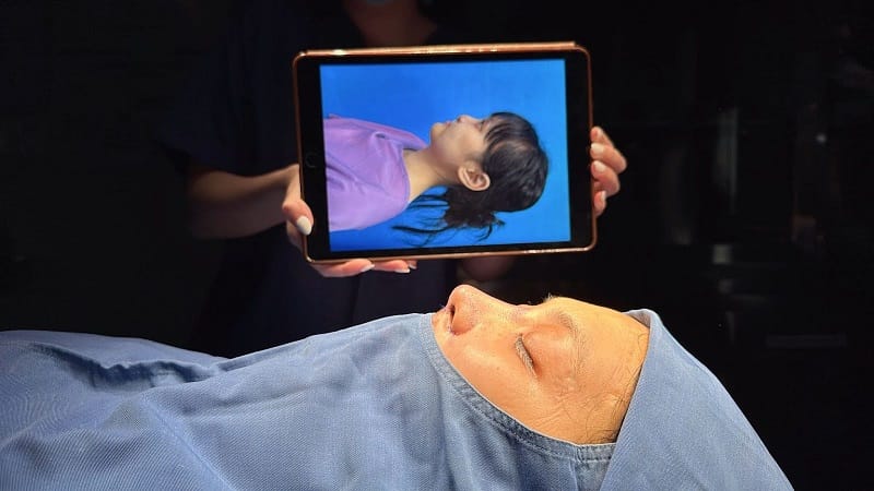 Nâng mũi cấu trúc có thể cải thiện dáng mũi toàn diện.