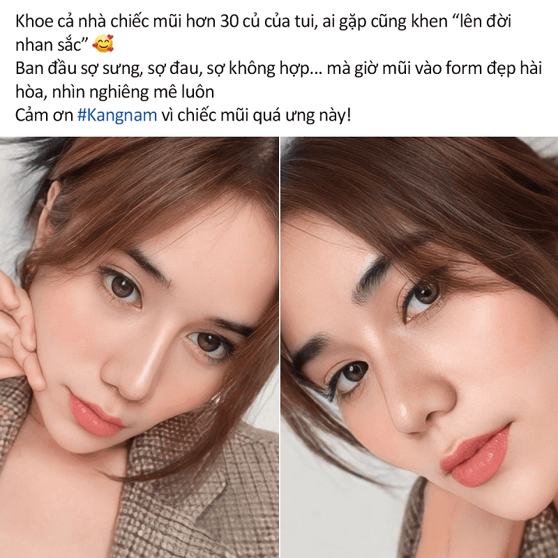 Khách hàng khen dáng mũi vào form đẹp hài hòa