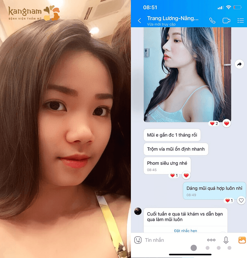Khách hàng Trang Lương ưng ý với dáng mũi mới