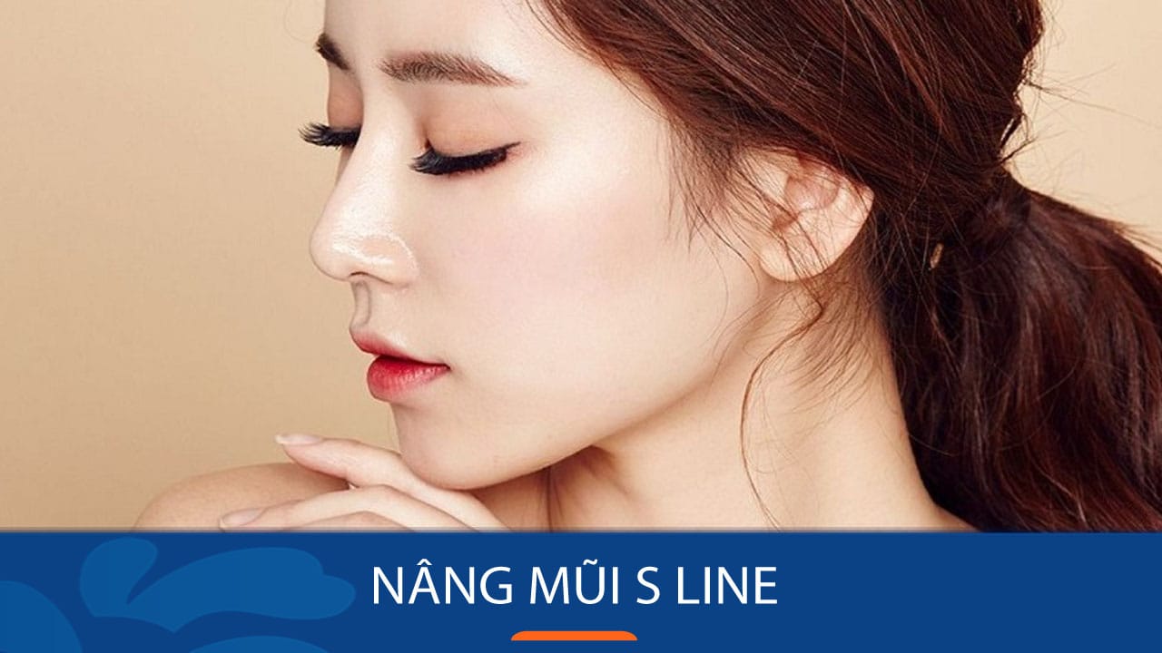 Nữ Việt Kiều Nâng mũi S Line – Công nghệ nâng mũi tự nhiên