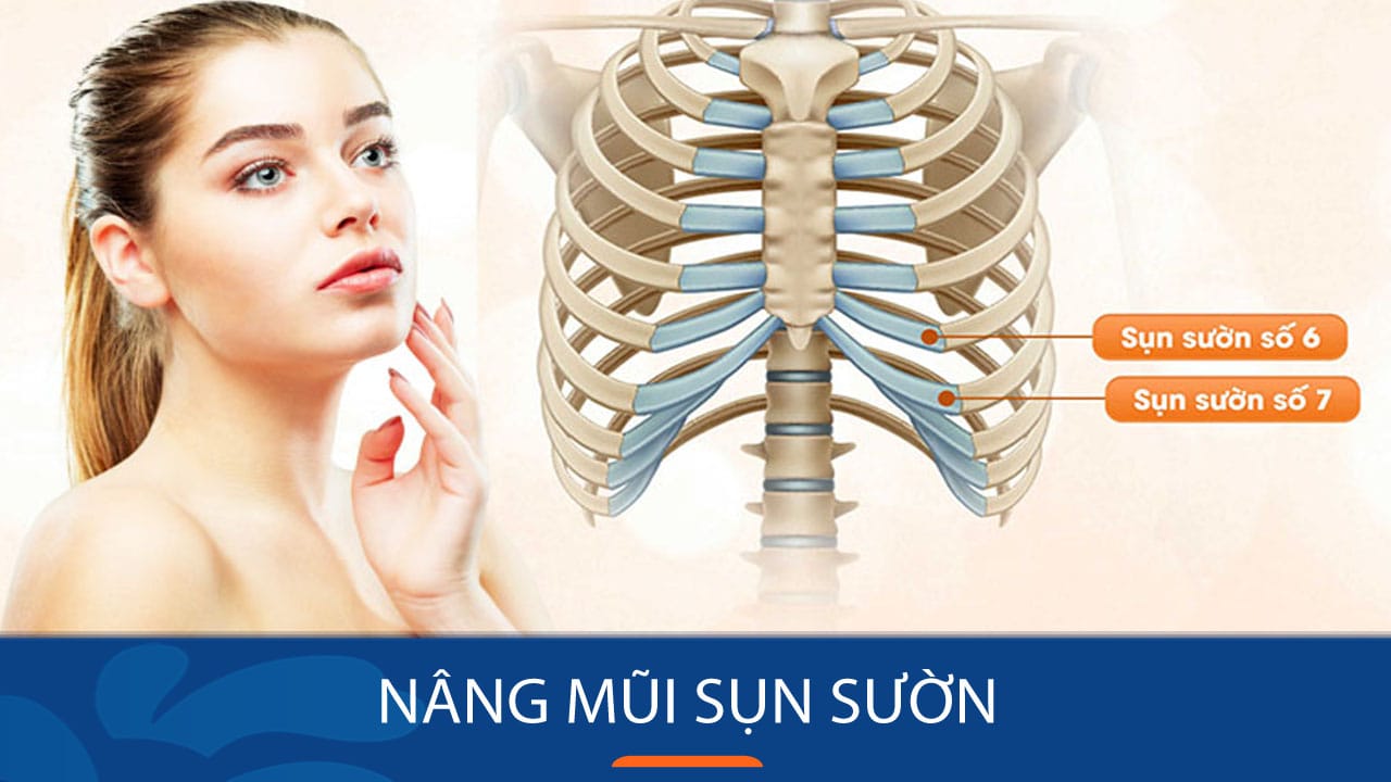 Nâng mũi sụn sườn cho KH việt kiều: Địa chỉ nâng mũi uy tín