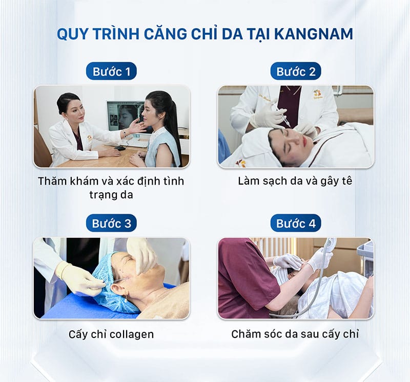 Quy trình căng chỉ da tại Kangnam