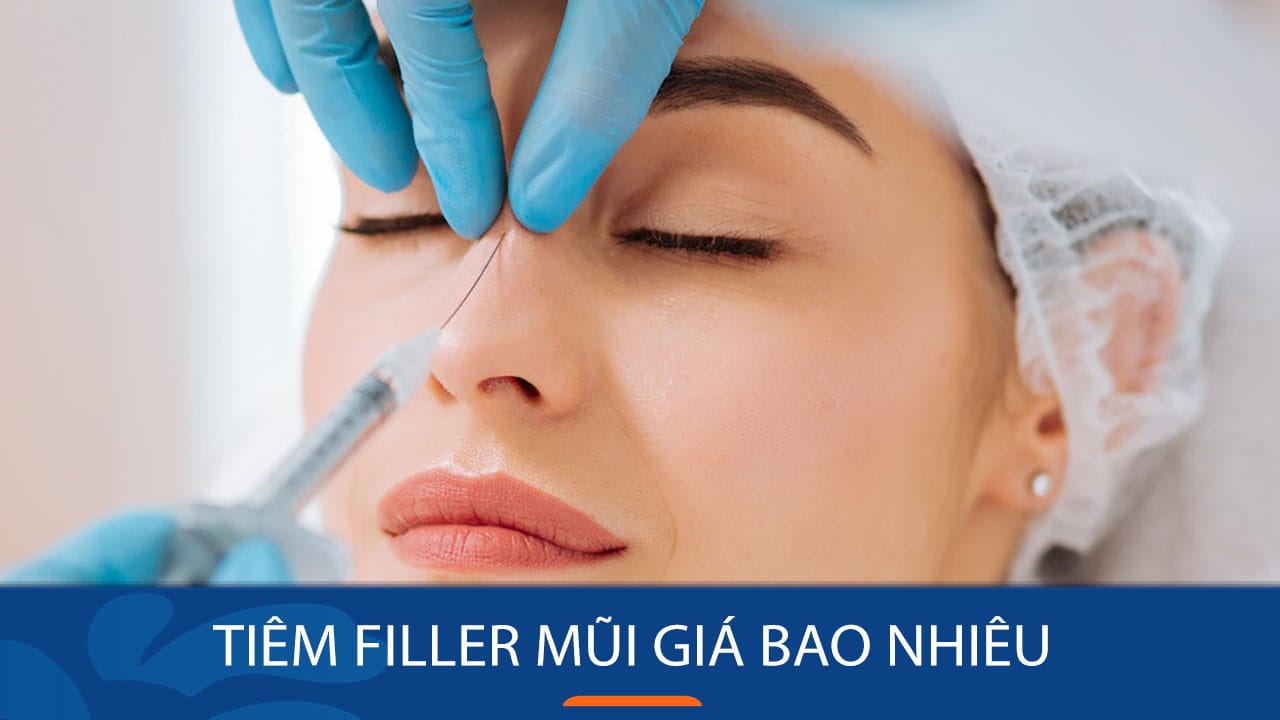 Tiêm filler mũi giá bao nhiêu? Chi phí ưu đãi cho KH Việt Kiều