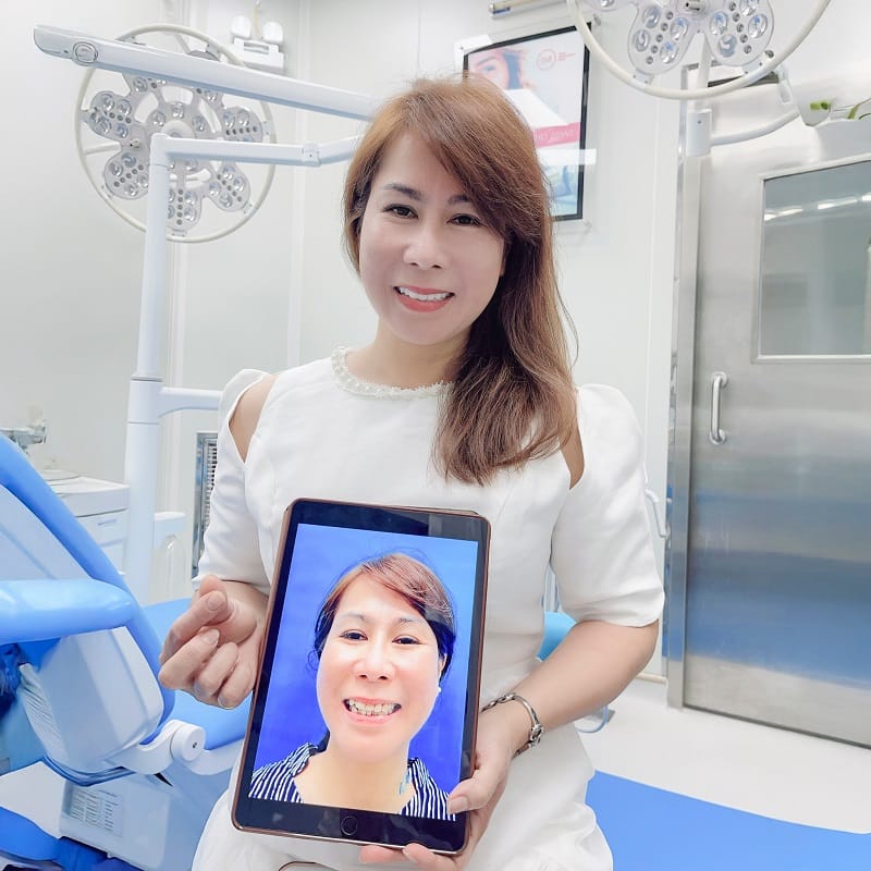 Ứng dụng các loại cầu răng sứ cao cấp, phù hợp với nhiều khách hàng