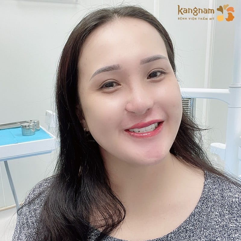 Bọc răng sứ cao cấp tại Kangnam không lo biến chứng