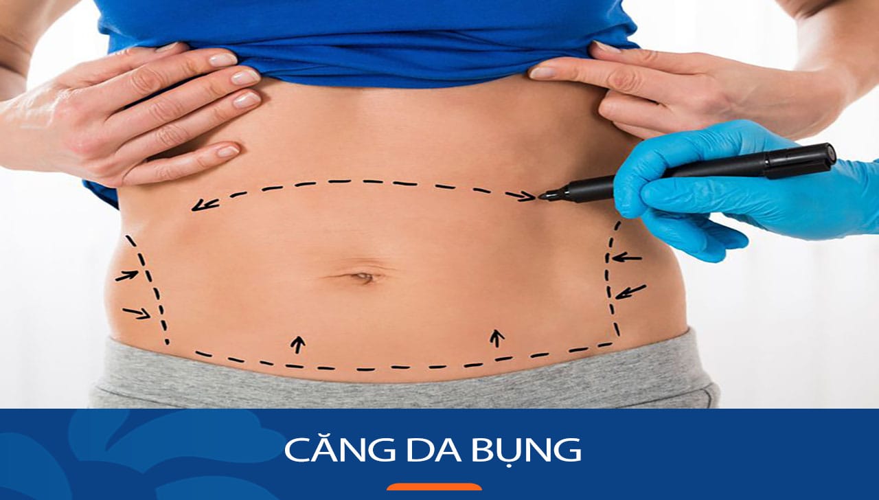 Việt Kiều đổ xô về nước làm Căng da bụng tại BV Kangnam